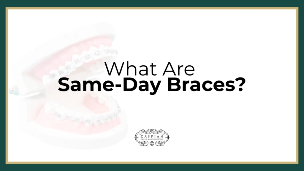 Same-Day Braces: The Fast, Modern Way to Transform Your Smile in Lauderdale Lakes, FL