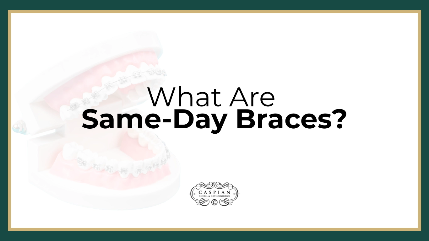 Same-Day Braces: The Fast, Modern Way to Transform Your Smile in Lauderdale Lakes, FL
