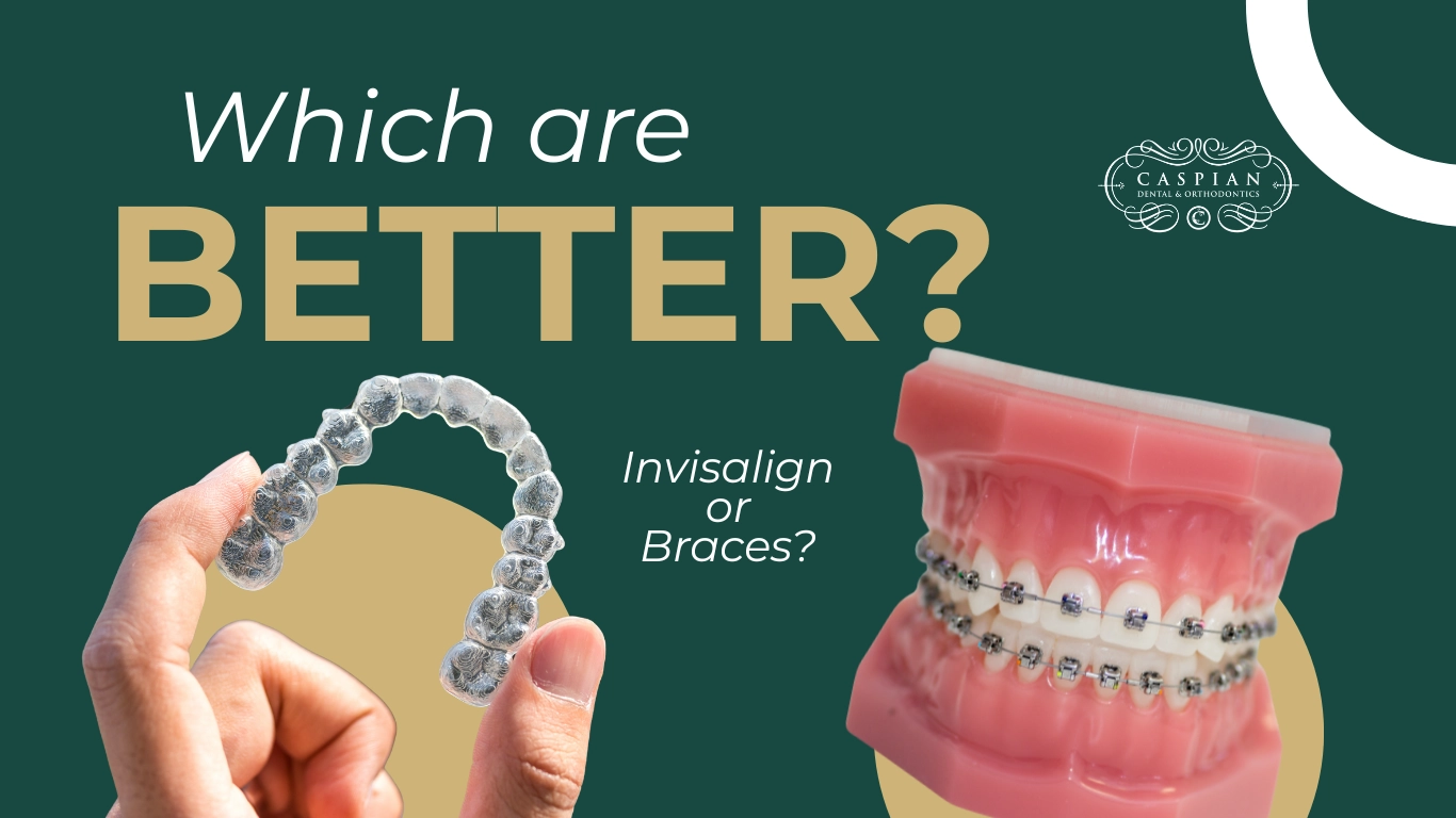 Invisalign vs. Traditional Braces: Which Option Is Right for You?
