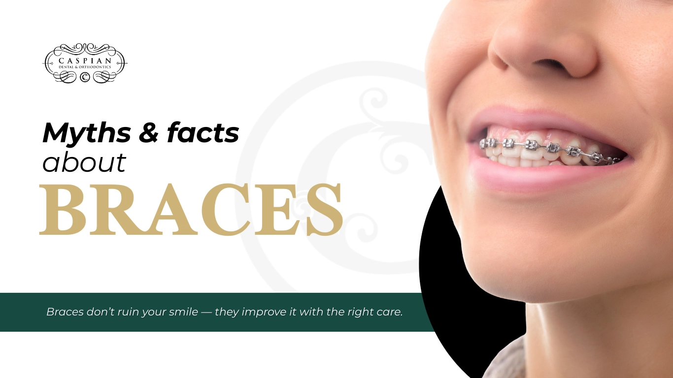 When it comes to braces, there’s a lot of misinformation floating around. Many people think braces are uncomfortable, only for teens, or even purely cosmetic. At Caspian Orthodontics, we know that the truth is far more positive—and sometimes even surprising! In this blog, we’ll bust some of the most common myths about braces, share a few celebrity stories, and give tips for keeping your smile healthy and confident. Myth #1: Braces Are Just for Teens Fact: Adults are getting braces more than ever. From movie stars like Nicole Kidman to tech leaders, many adults are choosing orthodontic treatment to improve both their smile and oral health. Why it matters: Whether you’re 15 or 55, it’s never too late to correct misaligned teeth. Modern options like clear braces or Invisalign make treatment virtually invisible and highly convenient for adults. Myth #2: Braces Hurt Fact: It’s normal to feel some mild discomfort, especially after adjustments, but it’s usually manageable. Think of it as the “pressure” that moves your teeth into better positions. Tip from Caspian Orthodontics: Use orthodontic wax, soft foods, or over-the-counter pain relievers to stay comfortable during the first few days after an adjustment. Our team ensures the process is smooth and supportive. Myth #3: Braces Limit Everything You Eat Fact: You won’t need to give up all your favorite foods. Sticky candies, hard nuts, and popcorn kernels should be avoided, but you can enjoy most meals without worry. Cutting food into bite-sized pieces and choosing safe alternatives makes eating easy. Bonus: Some patients even enjoy fun-colored elastics to make mealtime playful! Myth #4: Braces Are Unattractive Fact: Modern braces are stylish, subtle, and customizable. Clear ceramic braces and invisible aligners make orthodontic treatment almost undetectable. Celebrity trend: Celebrities like Gwen Stefani and Zac Efron have embraced braces at different points in their lives, proving that braces can be a temporary accessory that leads to a stunning final result. Myth #5: Braces Are Only Cosmetic Fact: Braces do more than improve your appearance—they improve oral health. Straight teeth are easier to clean, help prevent cavities and gum disease, and can even correct bite issues that affect jaw health. Remember: Investing in braces now saves potential dental problems in the future. A straight smile is a healthy smile. Fun Fact: Braces Can Be Fashionable Colored elastics aren’t just for kids! Many teens and adults use them to express their personality. From subtle pastels to bold, bright colors, braces can be fun and stylish. Clear braces are also a great option for those who want a more understated look. Frequently Asked Questions (FAQ) 1. How long will I need braces? Most patients wear braces between 12–36 months. Your orthodontist at Caspian Orthodontics will provide a personalized treatment plan. 2. Are braces painful? Mild soreness is normal, especially after adjustments. Modern braces move teeth gently, and we provide guidance to minimize discomfort. 3. Can I play sports or musical instruments with braces? Yes! A mouthguard is recommended for contact sports. Most instruments are fine, though brass players may need a short adjustment period. 4. Will I need retainers afterward? Yes. Retainers help maintain your new smile and prevent teeth from shifting back over time. 5. Can I afford braces? At Caspian Orthodontics, we offer flexible payment plans and accept most insurance providers to make treatment accessible. Ready for Your Best Smile? At Caspian Orthodontics, we make braces approachable, comfortable, and even fun! If you’ve been putting off orthodontic treatment because of myths or fears, now is the perfect time to get the facts—and start your smile journey. Contact us today to schedule a consultation. Whether you’re a teen or an adult, braces can improve your confidence, health, and overall smile. Let us help you shine with a smile you’ll love for years to come.